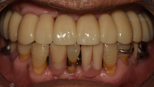 치료 후 이미지