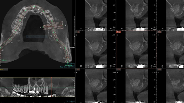치료 후 이미지