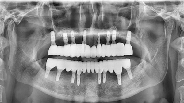 치료 후 이미지