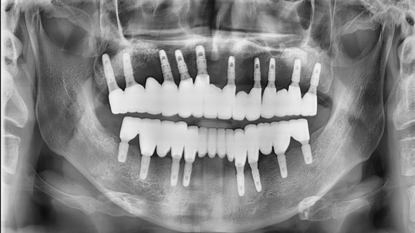 치료 후 이미지