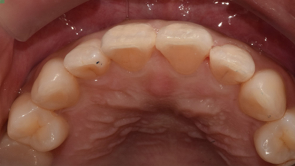 치료 후 이미지