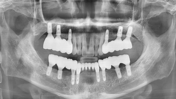 치료 후 이미지